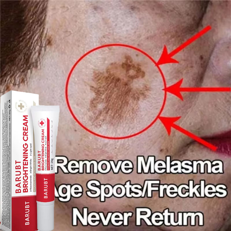 Vitamin C Serum Face - Potente Crema Blanqueadora para Eliminar Manchas,
