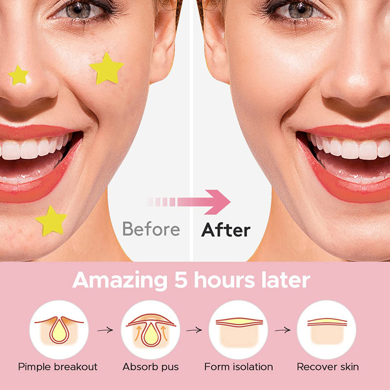 600 unids/set estrella parche  - Beauty Makeup Face reseña y precio