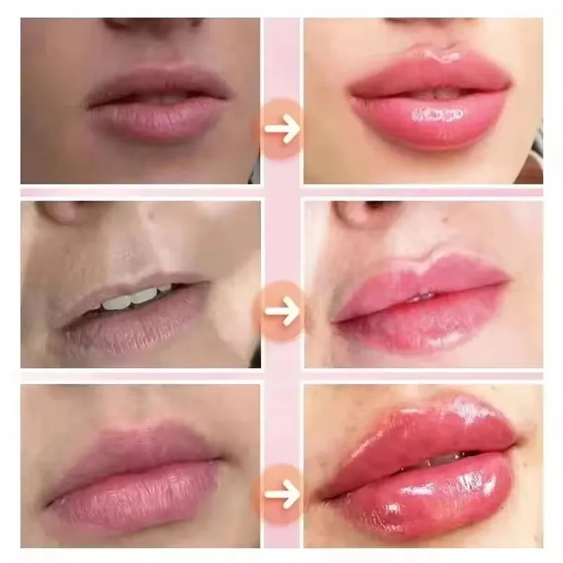 Aceite esencial para rellenar  - Lip Gloss Plumping reseña y precio
