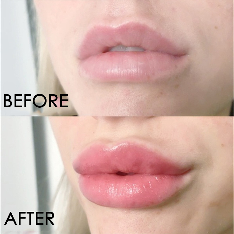 Suero para el cuidado de los l - Lip Gloss Plumping reseña y precio