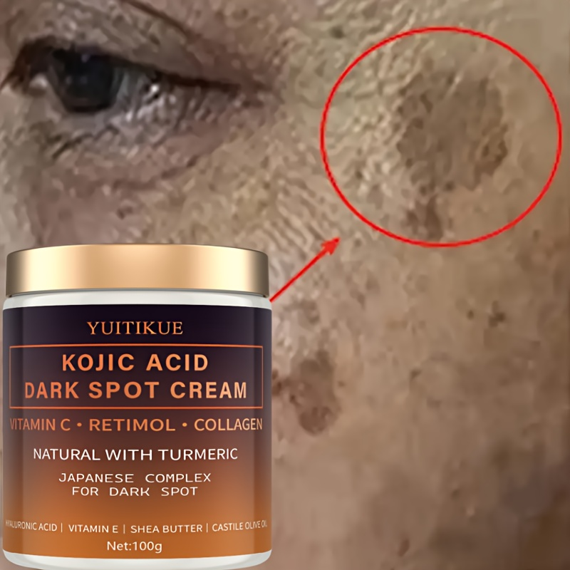 Crema decolorante de arbutina, - Vitamin C Serum Face reseña y precio